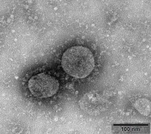 corona-virus.jpg (480×428)